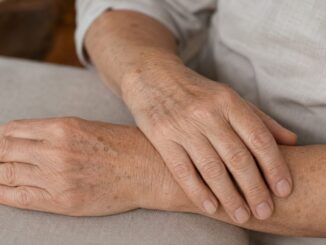 Hände einer älteren Frau mit Altersflecken als Beispiel für Hautveränderungen im Alter